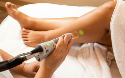 The Ultimate Guide to Laser Hair Removal in Ann Arbor