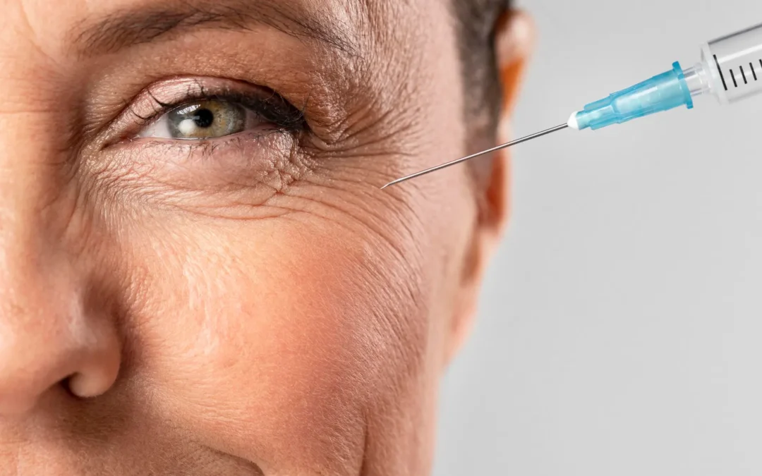 Can You Lay Down After Botox in Ann Arbor? Timing for Optimal Results Explained